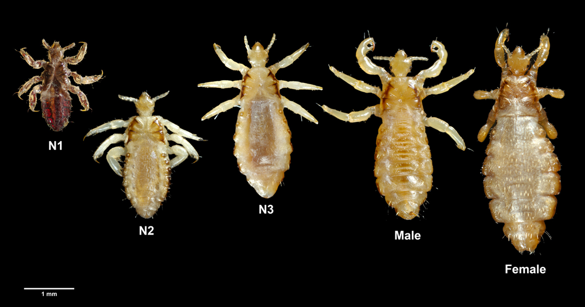 What Can Kill Pubic Lice